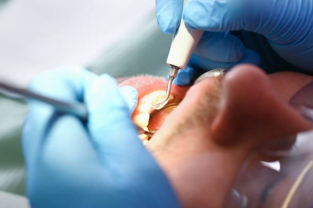 Best Emergency Dental Care for Sports Injuries in Paoli, IN