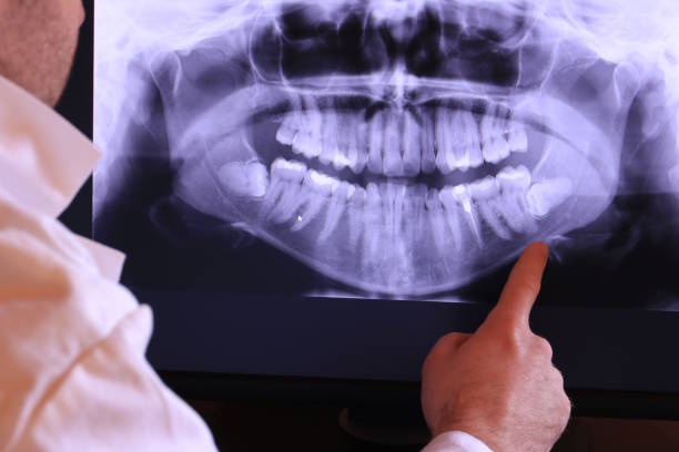 Best Emergency Treatment for Jaw Pain or Injury in Paoli, IN